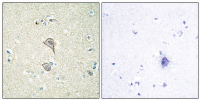 Anti-NKTR antibody produced in rabbit affinity isolated antibody