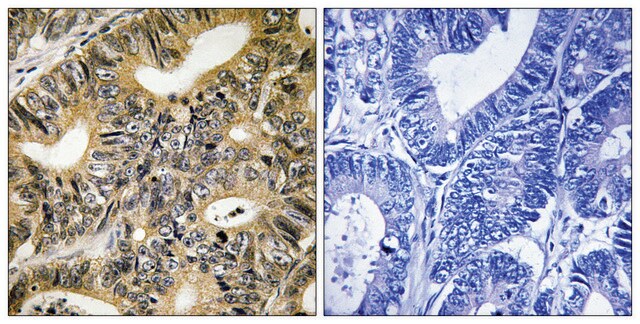 Anti-phospho-4E-BP1 (pThr70) antibody produced in rabbit affinity isolated antibody