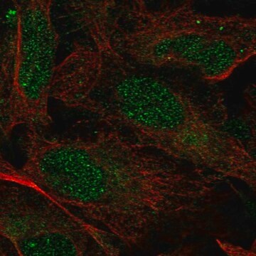 Anti-Prpf39 Antibody Produced In Rabbit Prestige Antibodies&#174; Powered by Atlas Antibodies, affinity isolated antibody, buffered aqueous glycerol solution