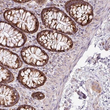 Anti-ZNF81 antibody produced in rabbit Prestige Antibodies&#174; Powered by Atlas Antibodies, affinity isolated antibody, buffered aqueous glycerol solution