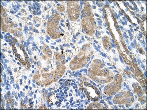 Anti-CYP2D6 antibody produced in rabbit IgG fraction of antiserum