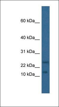 Anti-MAFK antibody produced in rabbit affinity isolated antibody