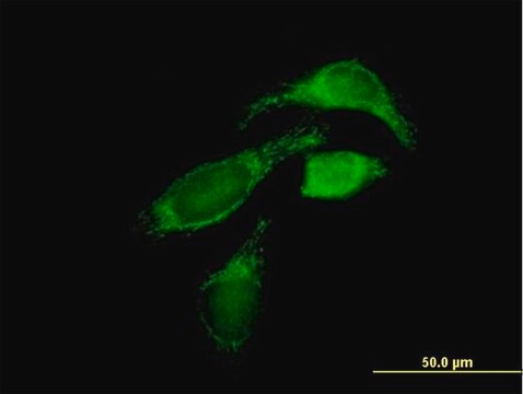 Anti-OXCT1 antibody produced in mouse purified immunoglobulin, buffered aqueous solution