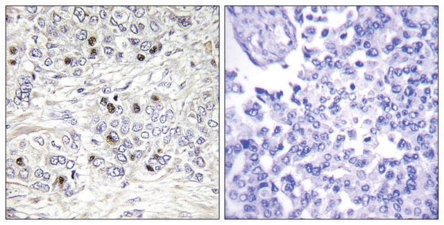 Anti-TEAD2 antibody produced in rabbit affinity isolated antibody