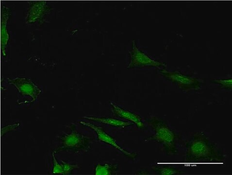 Monoclonal Anti-WBP2 antibody produced in mouse clone 3B1, purified immunoglobulin, buffered aqueous solution