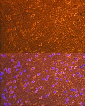 Anti-PSD93/chapsyn-110/DLG2 Antibody, clone 0G4O6, Rabbit Monoclonal