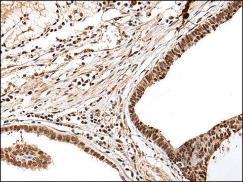 Anti-PTOV1 affinity isolated antibody