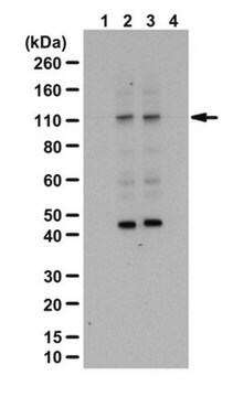 Anti-phospho ULK1 Antibody (Thr574) from rabbit, purified by affinity chromatography