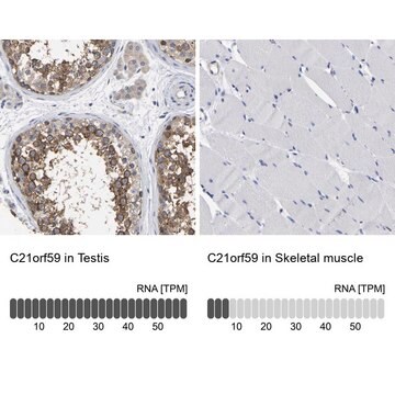 Anti-C21orf59 antibody produced in rabbit Prestige Antibodies&#174; Powered by Atlas Antibodies, affinity isolated antibody, buffered aqueous glycerol solution, Ab1