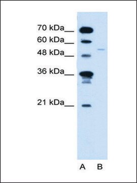 Anti-RXRG (AB2) antibody produced in rabbit IgG fraction of antiserum