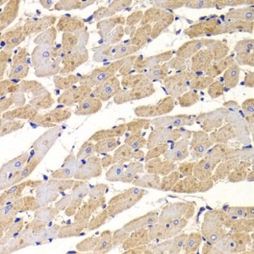 Anti- TTC11/FIS1 antibody produced in rabbit