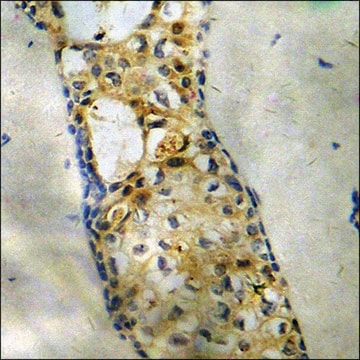 Anti-phospho-IL-9R (pSer519) antibody produced in rabbit affinity isolated antibody