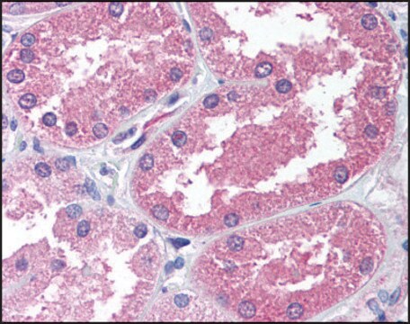 Anti-AADAT (AB1) antibody produced in rabbit affinity isolated antibody, buffered aqueous solution