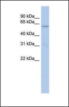 Anti-CAMKK2, (N-terminal) antibody produced in rabbit affinity isolated antibody