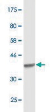 Monoclonal Anti-ACO1, (C-terminal) antibody produced in mouse clone 2F6, purified immunoglobulin, buffered aqueous solution