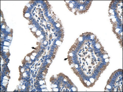 Anti-FUS antibody produced in rabbit affinity isolated antibody