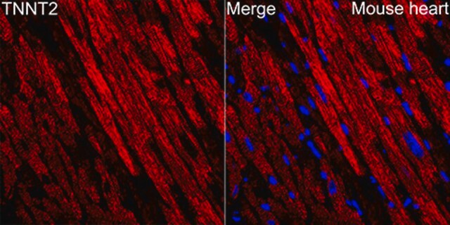 Anti-Cardiac troponin T (TNNT2) Antibody, clone 10H9D8, Rabbit Monoclonal