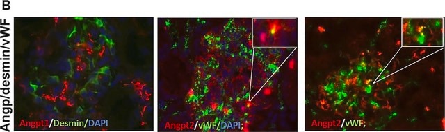 Anti-Desmin Antibody, clone DE-B-5 clone DE-B-5, Chemicon&#174;, from mouse