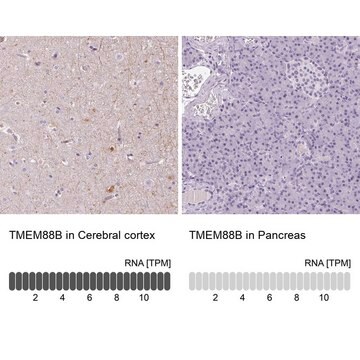 Anti-TMEM88B antibody produced in rabbit Prestige Antibodies&#174; Powered by Atlas Antibodies, affinity isolated antibody, buffered aqueous glycerol solution