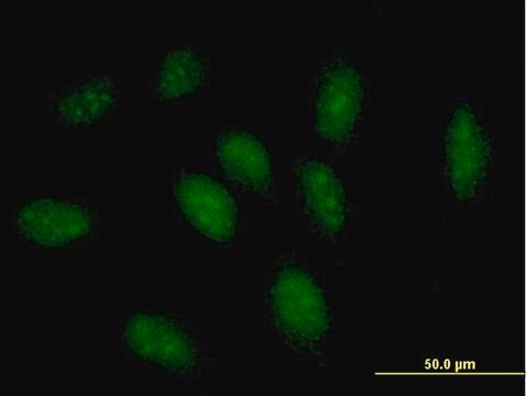 Anti-GCH1 antibody produced in mouse purified immunoglobulin, buffered aqueous solution