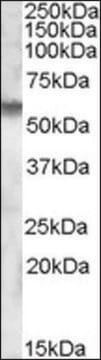 Anti-IDS antibody produced in goat affinity isolated antibody, buffered aqueous solution