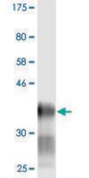 Monoclonal Anti-LY6H antibody produced in mouse clone 1D1, purified immunoglobulin, buffered aqueous solution