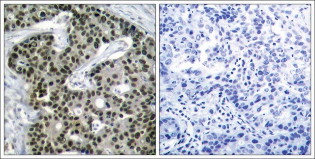 Anti-phospho-HSF1 (pSer303) antibody produced in rabbit affinity isolated antibody