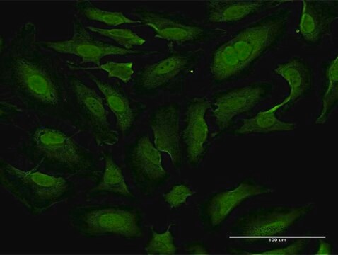 Monoclonal Anti-TKTL1 antibody produced in mouse clone 1D6, purified immunoglobulin, buffered aqueous solution