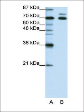 Anti-TRIM16 antibody produced in rabbit IgG fraction of antiserum