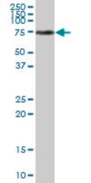 Anti-TKT antibody produced in mouse purified immunoglobulin, buffered aqueous solution