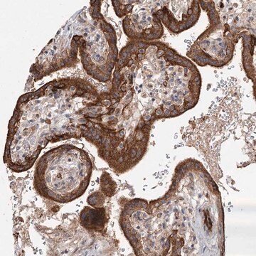 Anti-RAPGEF6 antibody produced in rabbit Prestige Antibodies&#174; Powered by Atlas Antibodies, affinity isolated antibody, buffered aqueous glycerol solution