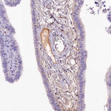 Anti-SOD3 antibody produced in rabbit Prestige Antibodies&#174; Powered by Atlas Antibodies, affinity isolated antibody, buffered aqueous glycerol solution