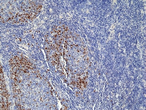 TOP2A (Topoisomerase II&#945;) Rabbit Monoclonal Antibody clone RM394, affinity purified immunoglobulin