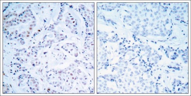 Anti-ESR1 (Ab-104) antibody produced in rabbit affinity isolated antibody