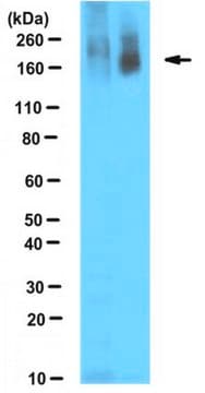 Anticorps anti-poly(ADP-ribose), clone&nbsp;10H clone 10H, from mouse