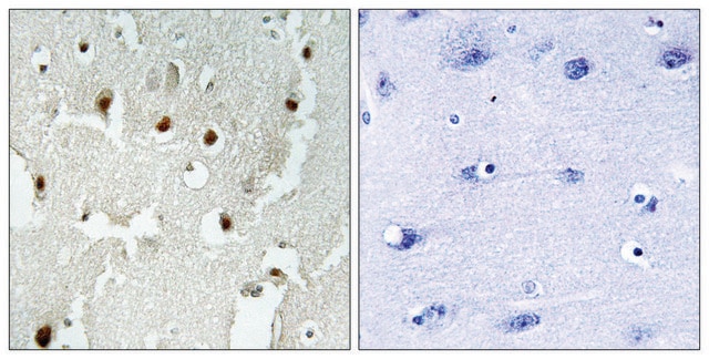 Anti-TREF1 antibody produced in rabbit affinity isolated antibody