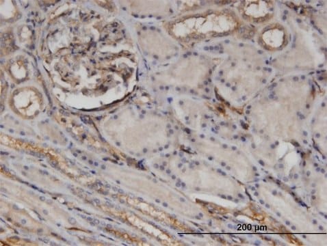 Monoclonal Anti-CTHRC1 antibody produced in mouse clone 1G12, purified immunoglobulin, buffered aqueous solution