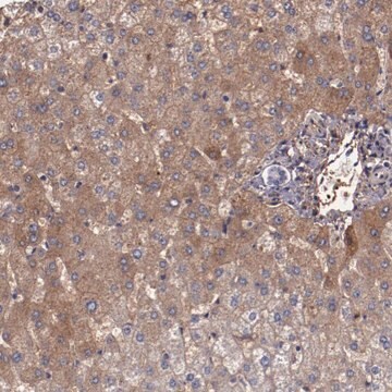 Anti-A2M antibody produced in rabbit Prestige Antibodies&#174; Powered by Atlas Antibodies, affinity isolated antibody, buffered aqueous glycerol solution