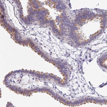 Anti-PINLYP antibody produced in rabbit Prestige Antibodies&#174; Powered by Atlas Antibodies, affinity isolated antibody, buffered aqueous glycerol solution