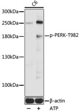 Anti-Phospho-PERK-T982 antibody produced in rabbit