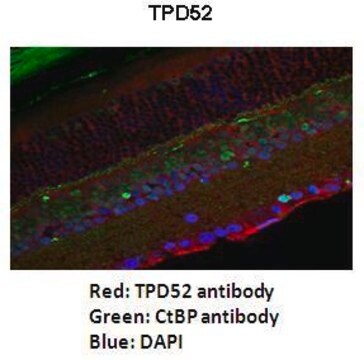 Anti-TPD52 antibody produced in rabbit affinity isolated antibody