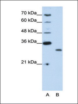 Anti-CPXCR1 antibody produced in rabbit IgG fraction of antiserum