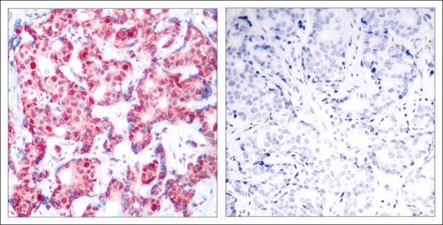 Anti-phospho-GATA1 (pSer142) antibody produced in rabbit affinity isolated antibody