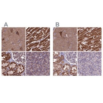 Anti-CS antibody produced in rabbit Prestige Antibodies&#174; Powered by Atlas Antibodies, affinity isolated antibody, buffered aqueous glycerol solution