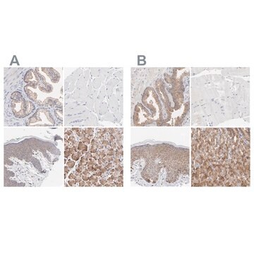 Anti-PPFIBP2 antibody produced in rabbit Ab1, Prestige Antibodies&#174; Powered by Atlas Antibodies, affinity isolated antibody, buffered aqueous glycerol solution