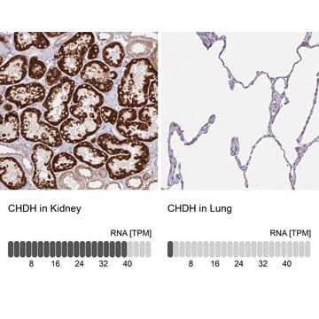 Anti-CHDH antibody produced in rabbit Prestige Antibodies&#174; Powered by Atlas Antibodies, affinity isolated antibody, buffered aqueous glycerol solution