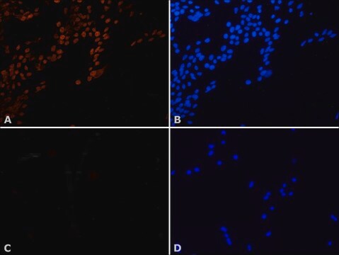 Anti-p8/TTD-A (N-terminal) antibody produced in rabbit IgG fraction of antiserum, buffered aqueous solution