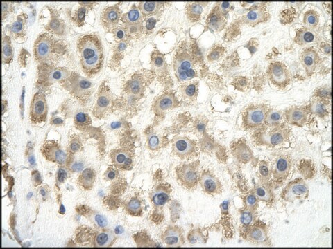 Anti-GPC3 antibody produced in rabbit IgG fraction of antiserum