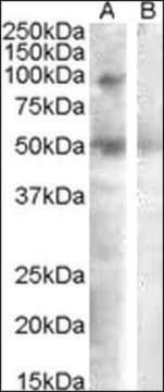 Anti-SULF2 antibody produced in goat affinity isolated antibody, buffered aqueous solution