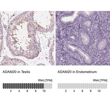 Anti-ADAM20 antibody produced in rabbit Prestige Antibodies&#174; Powered by Atlas Antibodies, affinity isolated antibody, buffered aqueous glycerol solution